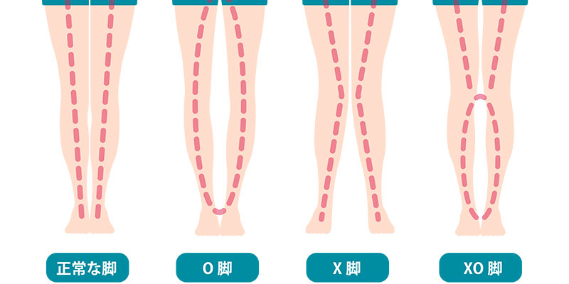 XO脚の説明